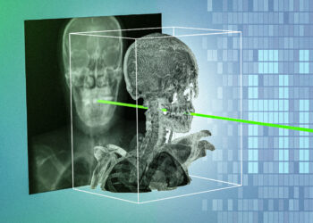 New AI technique could make minimally invasive surgeries safer and more precise | MIT News