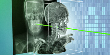 New AI technique could make minimally invasive surgeries safer and more precise | MIT News