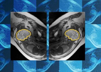 Why teaching AI about symmetry could make prenatal diagnosis more reliable | MIT News